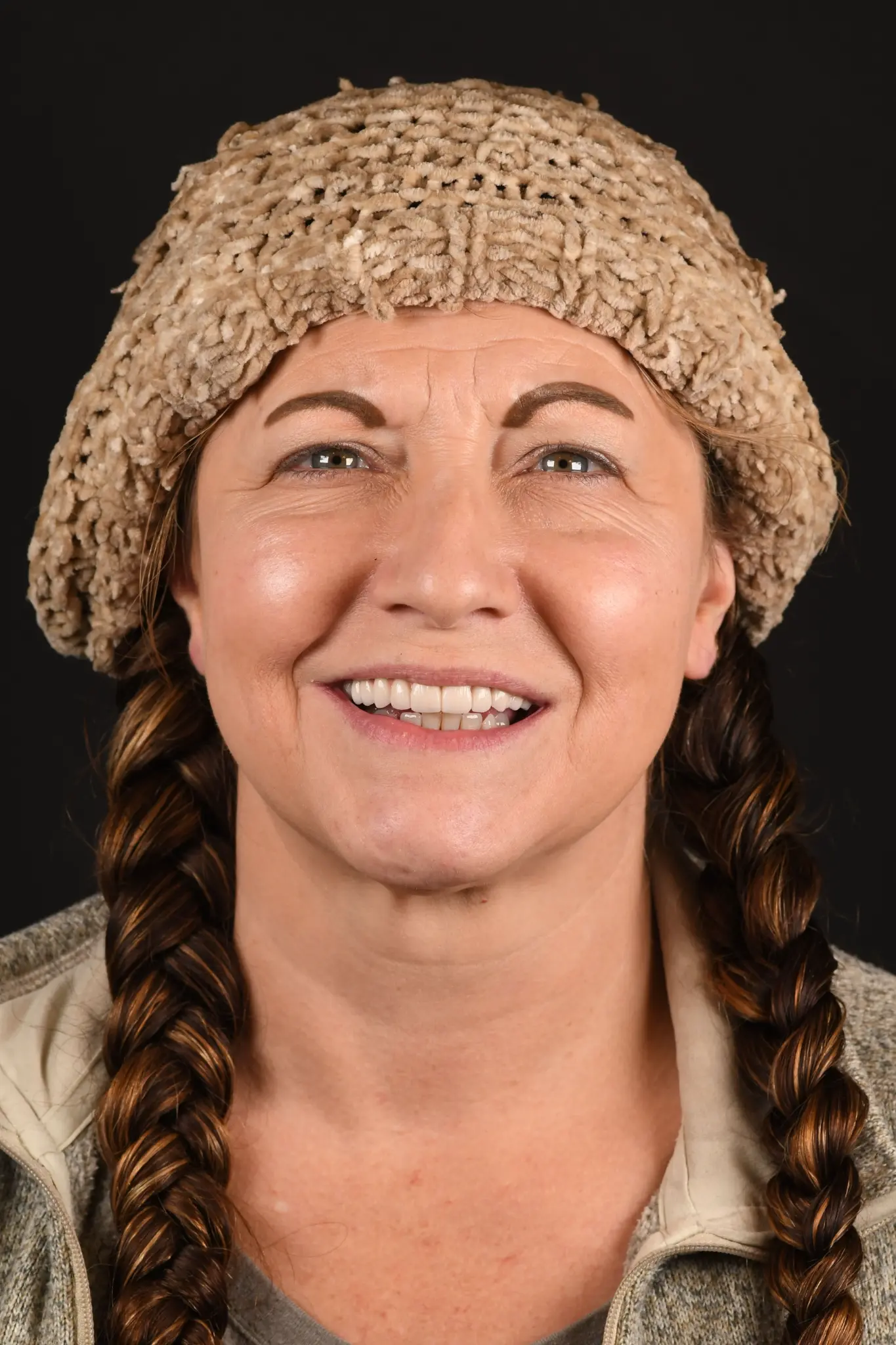 Paula after Upper All-on-X implant treatment with Dr. Constantine