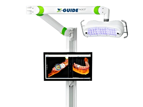 X-Guide dynamic navigation system for dental implant surgery